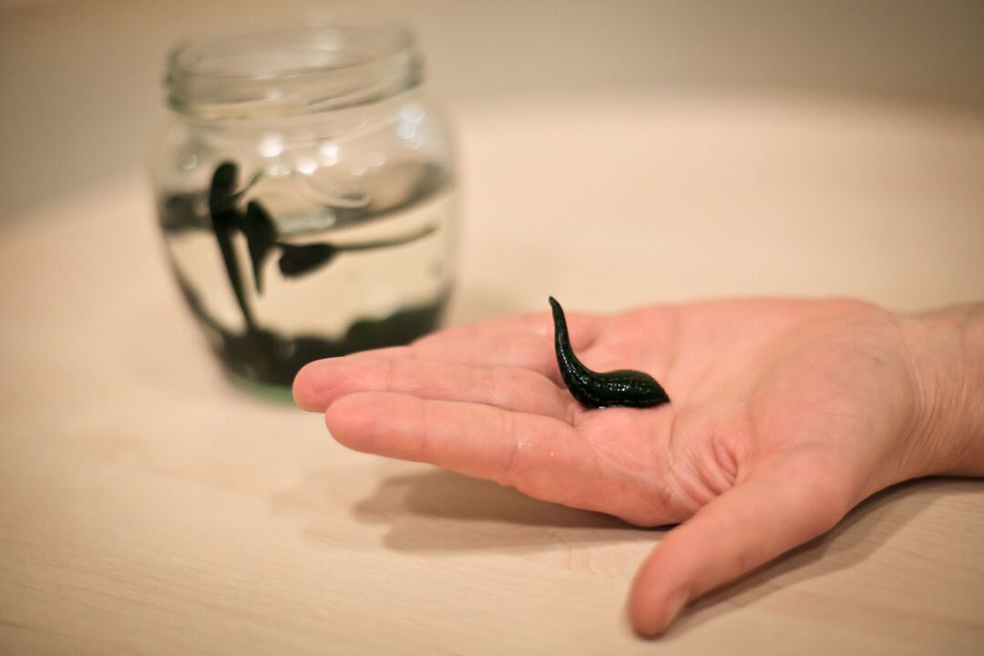 Leeches bakal ngawula ka salaku bahan baku pikeun produksi krim nu ngarangsang tumuwuhna sirit